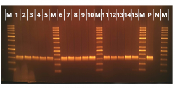 Human DNA 추출 & PCR 실험