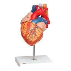 관상동맥 우회술 심장 모형